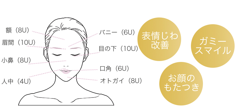 お悩み①表情じわ・ガミースマイル・もたつき